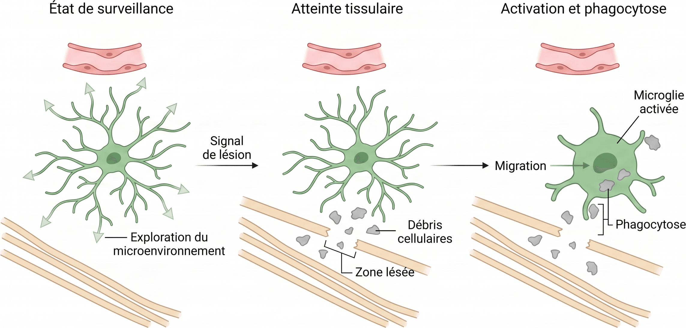 Passage de la microglie de la surveillance à la phagocytose