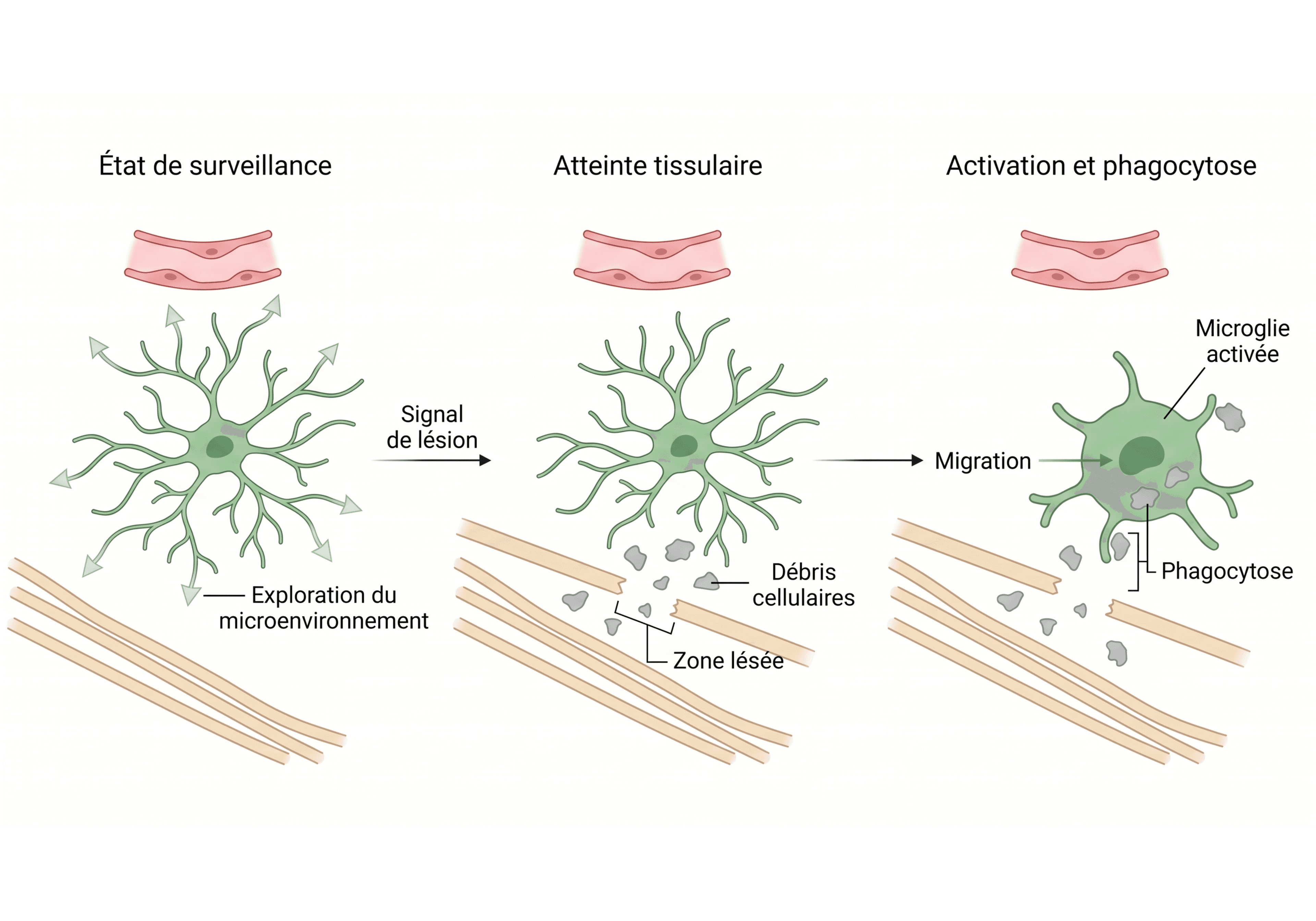 Passage de la microglie de la surveillance à la phagocytose