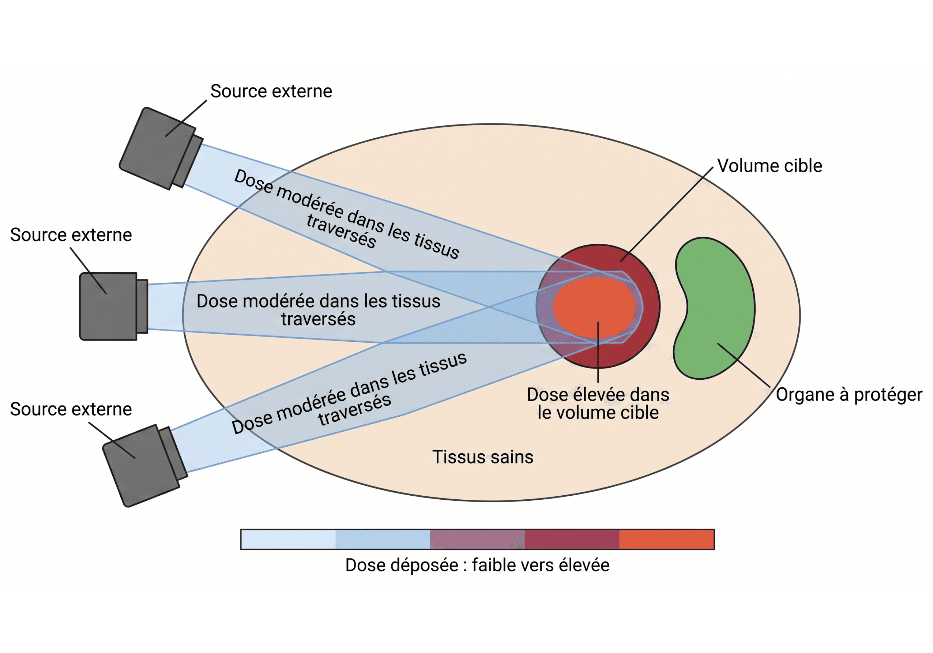 Convergence de faisceaux en irradiation externe