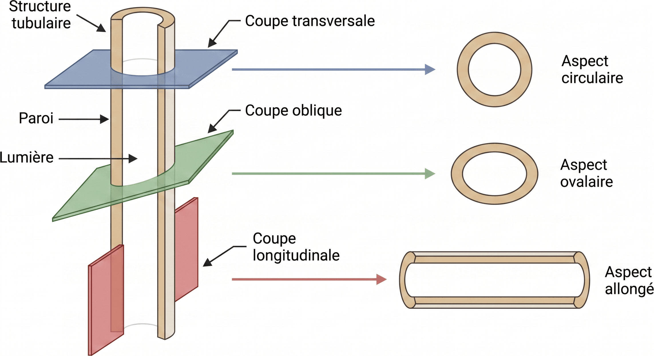 Aspect d'un tube selon le plan de coupe