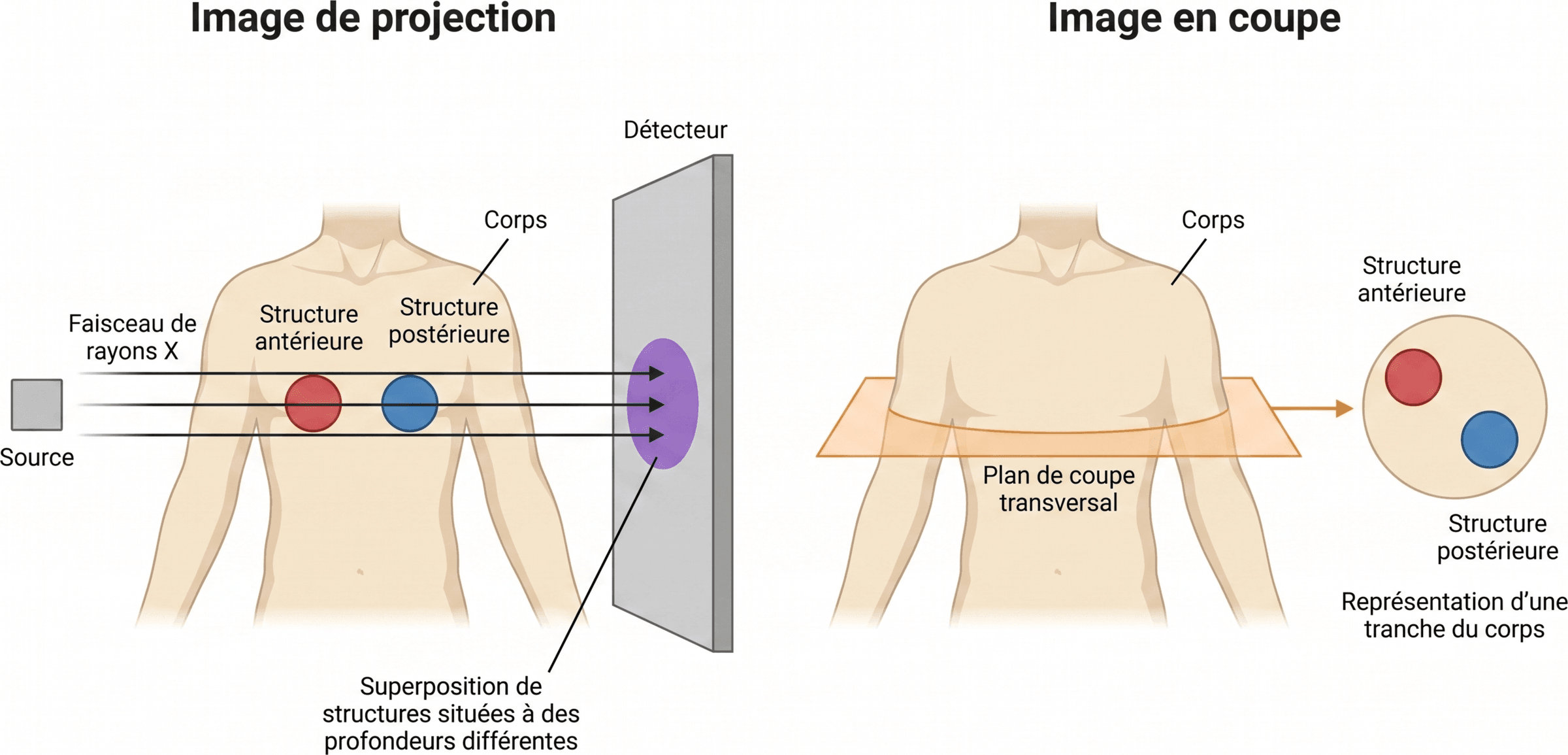 Projection et image en coupe : deux représentations différentes